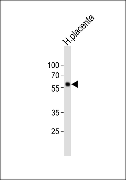 FOXO4 Antibody (C-term)