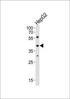 Mouse Lhx1 Antibody (C-term)