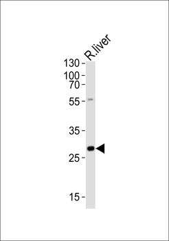 Rat Olig3 Antibody (Center)