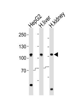 MTTP Antibody (C-term)