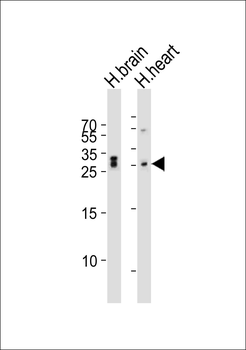 CHMP3 Antibody (N-term)