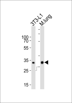 CHMP3 Antibody (N-term)