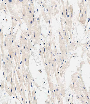 EHD2 Antibody (C-term)