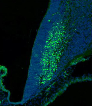 SKOR2 Antibody (C-term)