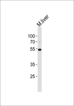 (Mouse) Gnl3 Antibody (C-term)