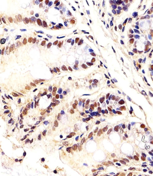 Mouse Ctr9 Antibody (C-term)