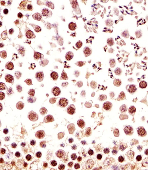 Mouse Ctr9 Antibody (C-term)
