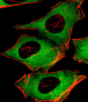 PIP4K2A Antibody (C-term)