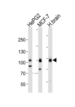 TLE1 Antibody (N-term)
