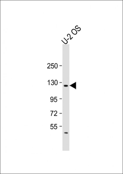 LIFR Antibody (C-term)