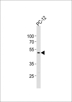 PIP4K2A Antibody (C-term)