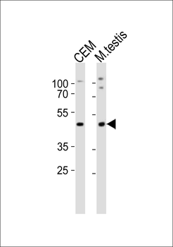 Mouse Lhx1 Antibody (Center)