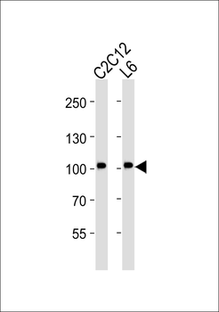 Musk Antibody