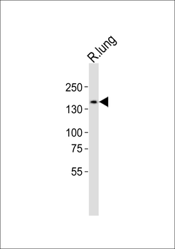 (Mouse) Jag1 Antibody (C-term)