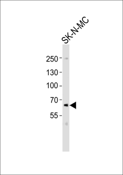 PCSK9 Antibody (C-term)
