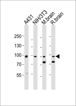 Mouse Ephb1 Antibody (Center)