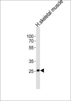 OLIG3 Antibody (Center)