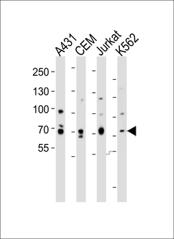 ITK Antibody (Center)