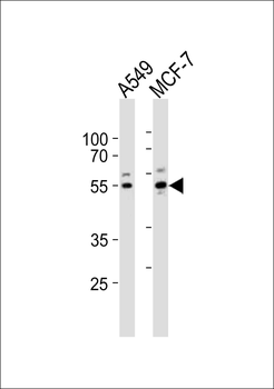PPP2R2C Antibody (N-term)