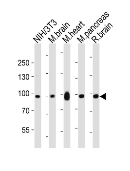 Ephb1 Antibody (Center)