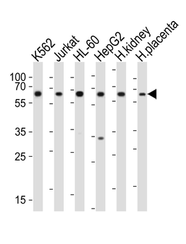 EPOR Antibody (C-term)