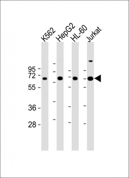 EPOR Antibody (C-term)