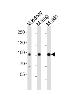 Mouse Epha1 Antibody (N-term)