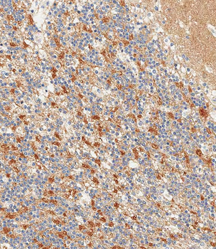 NCAM1 Antibody (C-term)