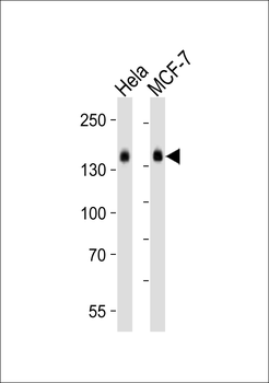 STAG2 Antibody (N-term)