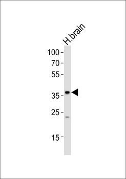 FOXN4 Antibody (Center)