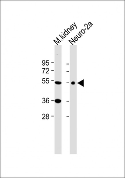 CLN3 Antibody (Center)