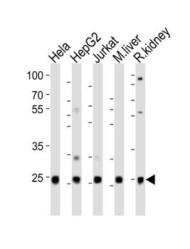 UBB(Ubiquitin) Antibody (N-term)