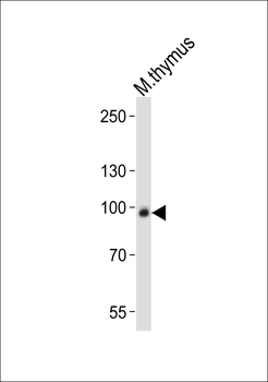 Mouse Rps6ka5 Antibody (C-term)