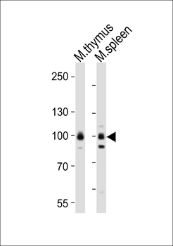 Mouse Rps6ka5 Antibody (C-term)