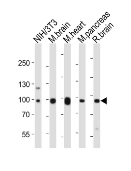 Ephb1 Antibody (Center)