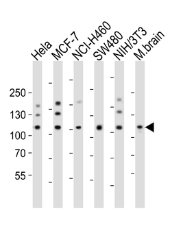 EPHA4 Antibody (Center)