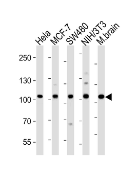 EPHA4 Antibody (Center)