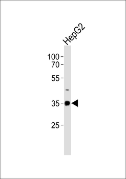 ABT1 Antibody (C-term)