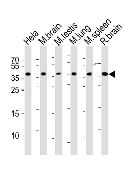 Cbx7 Antibody (C-term)