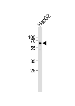 PET112 Antibody (N-term)