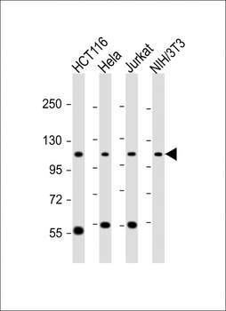 PRPF6 Antibody (N-term)