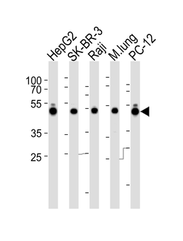 DNAJA1 Antibody (C-term)