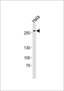 AHCTF1 (S1232) Antibody