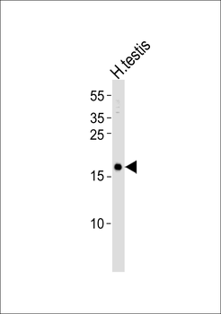 SPANXA1 Antibody (N-term)
