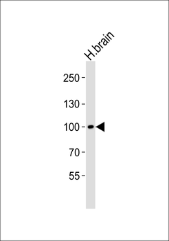 Mouse Ddr1 Antibody (Center)
