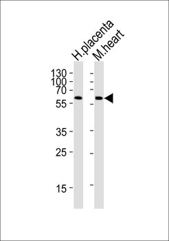 PPARG Antibody (N-term)