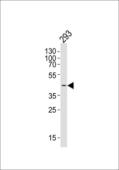 CERKL Antibody (N-term)