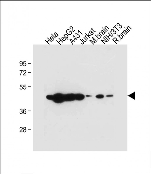 TUFM Antibody (N-term)