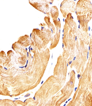 SMAD1 Antibody (Center)