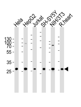 VAPB Antibody (Center)